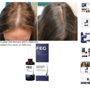 FEG Hair Growth Spray